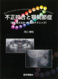 不正咬合と顎関節症　誰も教えなかった臨床テクニック