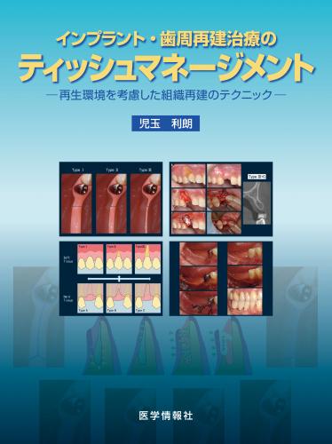 有限会社 医学情報社 / インプラント・歯周再建治療の ティッシュ 